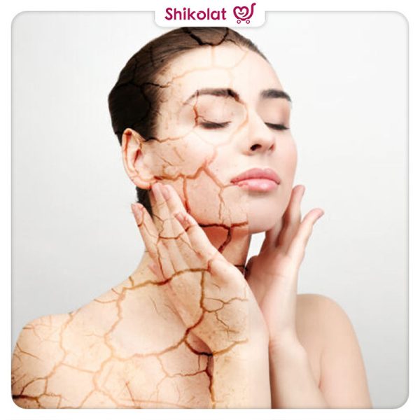 آبرسانی به پوست و جلوگیری از خشکی پوست صورت